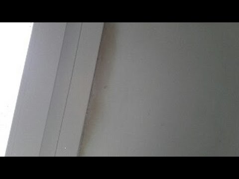 Dolore alla spalla e dolore quando si solleva il braccio trattamento Legamenti e un ginocchio rotto