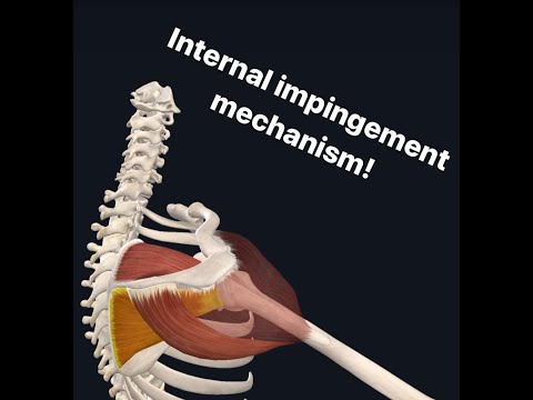 Internal Impingement