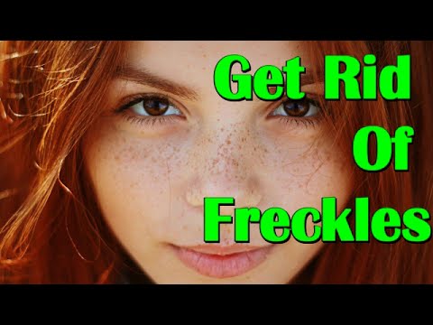 How To Get Rid Of Freckles Naturally and Fast