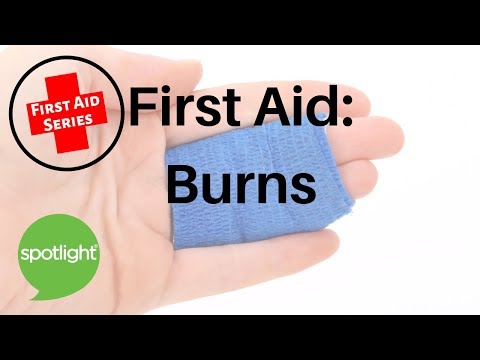 First Aid: Burns | practice English with Spotlight