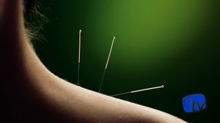Fibromialgia: tratamentos