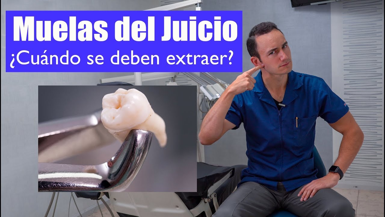 MUELAS DEL JUICIO | ¿EXTRAERLAS O NO CÓMO SABERLO “Cordales o terceros molares”