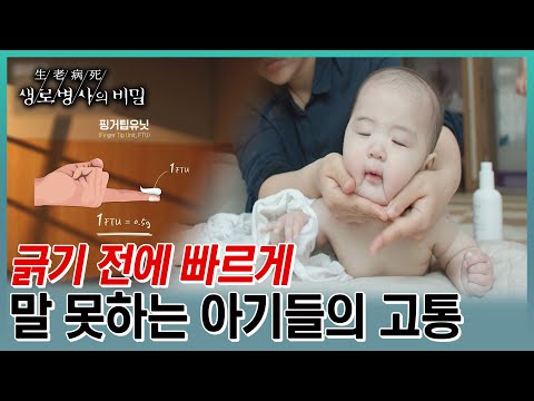 영유아기에 가장 많이 발현되는 아토피 피부염. 아기한테 스테로이드나 아토피 치료약을 쓰기가 두렵다고 마냥 피할수 없는 이유 (KBS 20230628 방송)