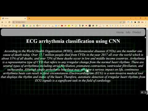 ECG Heart Beat using Image Classification in Python Projects