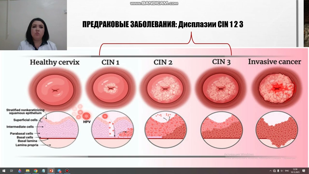 Фоновые и предраковые заболевания шейки матки