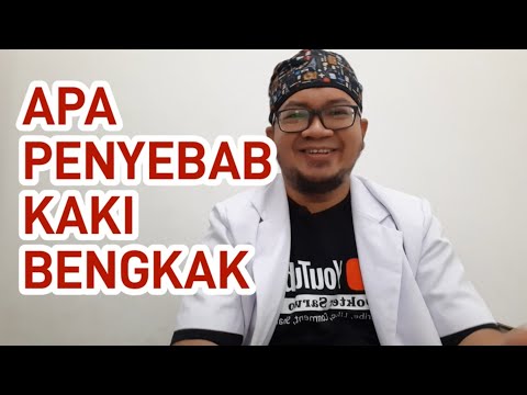 Apa Saja Penyebab Kaki Bengkak Tiba-tiba Benarkah Berbahaya