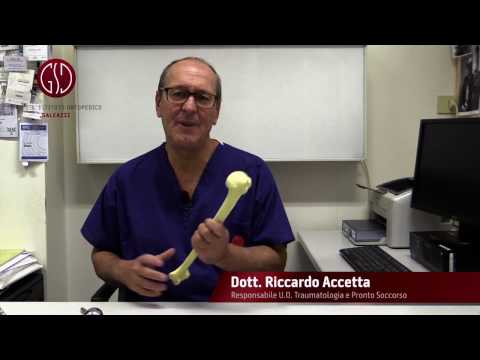 La risposta dell'Esperto - Traumatologia e pronto soccorso: frattura dell'omero