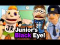 SML Movie Junior S Black Eye