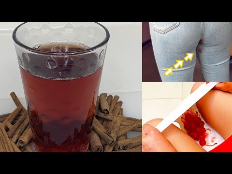 REMED POU REG KAP KOULE SAN RETE MEN KIJAN POU KANPEL