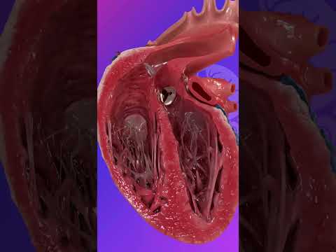 The Congenital Heart Defect  #healthcareeducation #medicalanimation #3danimation