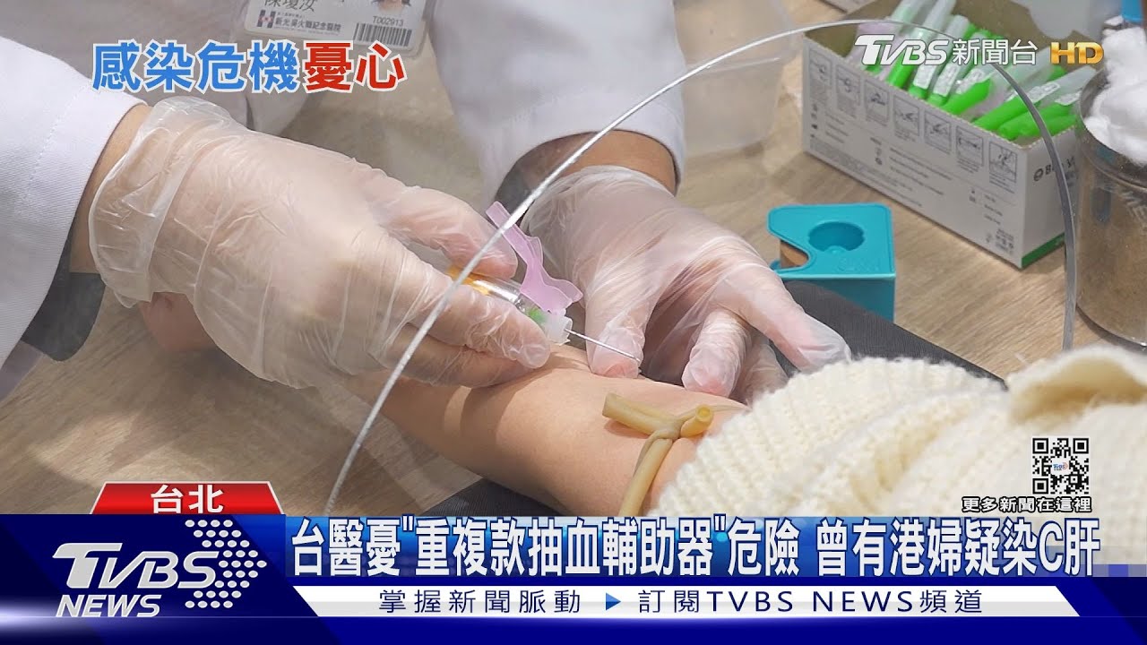 台醫憂「重複款抽血輔助器」危險 曾有港婦疑染C肝