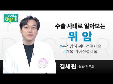 [TV닥터처방전] 수술 사례로 알아보는 위암