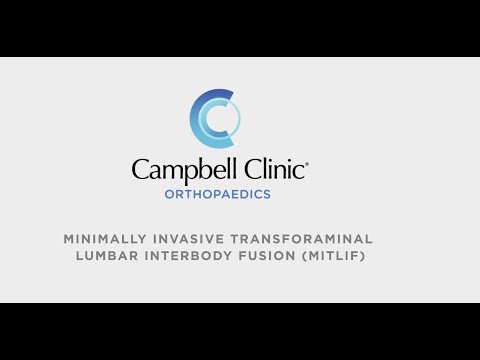 Minimally Invasive Transforaminal Lumbar Interbody Fusion at Campbell Clinic Orthopaedics