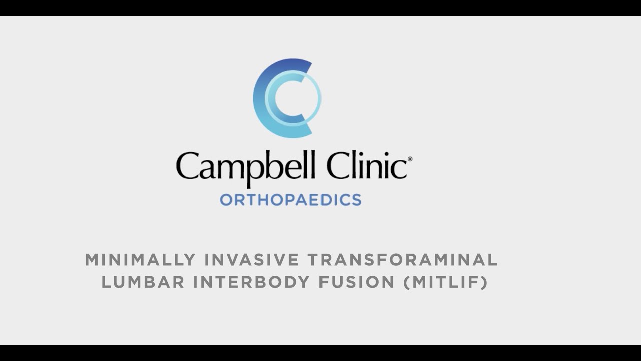 Minimally Invasive Transforaminal Lumbar Interbody Fusion at Campbell Clinic Orthopaedics