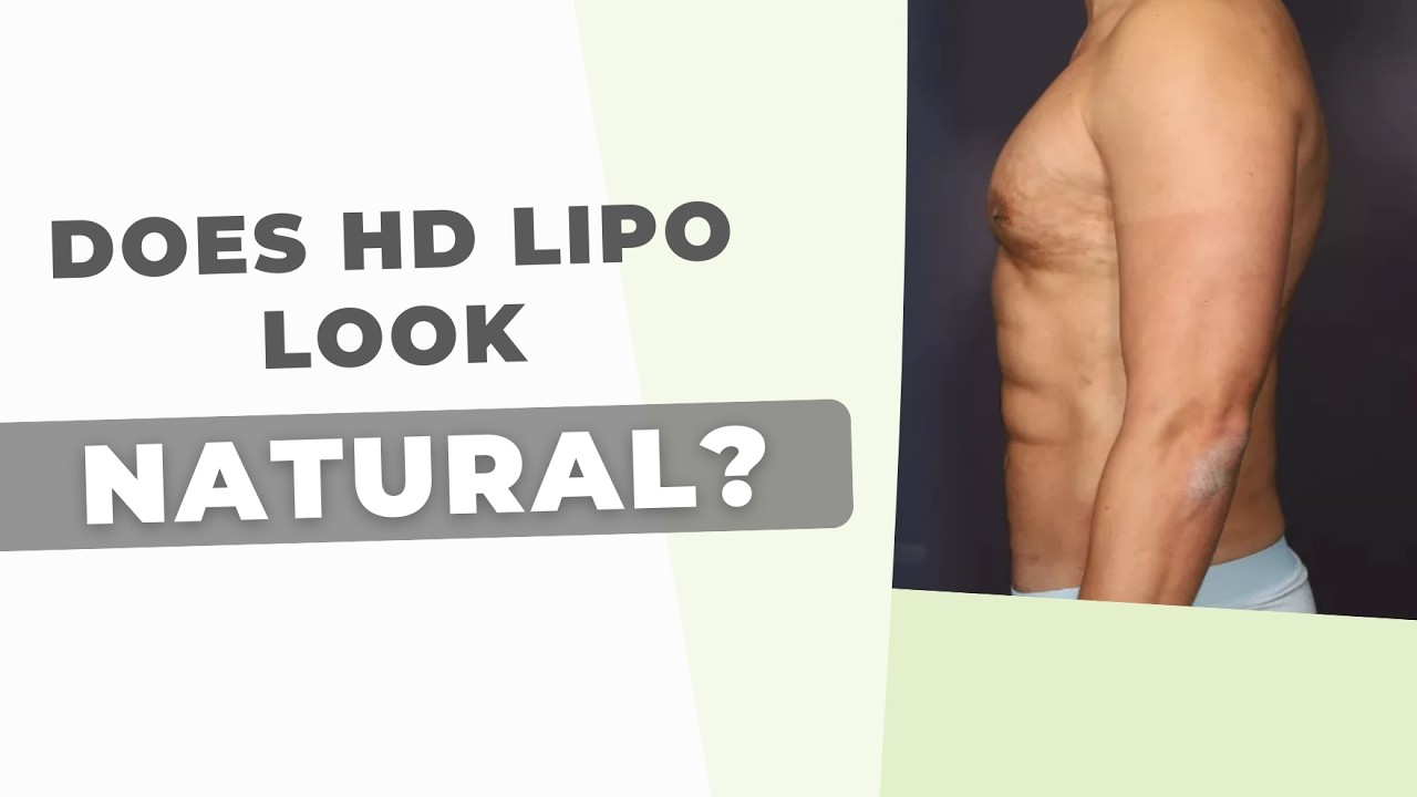 How Today’s HD Lipo Is Not What It Was Five Years Ago