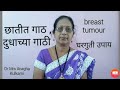 Breast Lump Breast Tumour छातीत गाठ होणे दुधाची गाठ हो