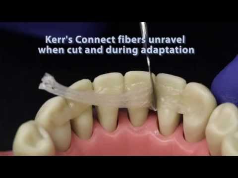 Ribbond compared to other dental fiber reinforcement materials