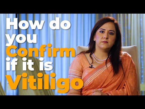 Dr Nitika Kohli Reveals 3 Ways To Confirm If Its Vitiligo