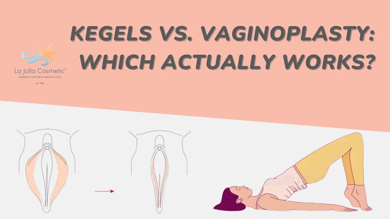 Plastic Surgeon Demystifies Vaginoplasty