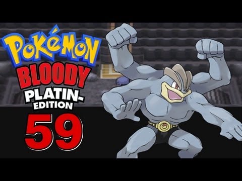 Let's Play Pokemon Bloody Platin [Nuzlocke-Challenge] Part 59 is Zero betrunken ?