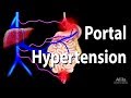 Portal Hypertension Animation