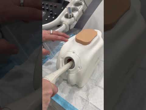 Have you had a transvaginal ultrasound?