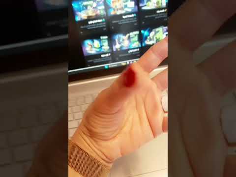 حياة