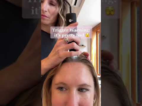 Scalp Cleanse For Dry Flaky Scalp #shorts