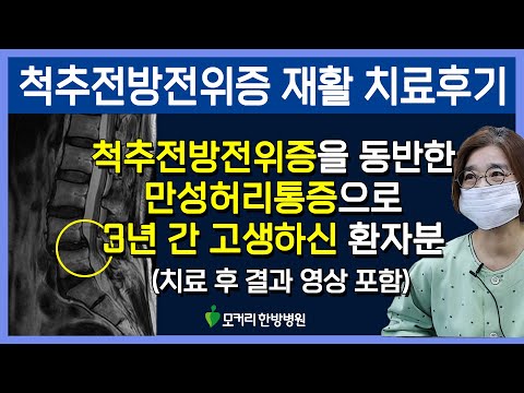 치료후기사진 입니다.