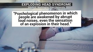 What&#39;s &quot;exploding head syndrome&quot;?