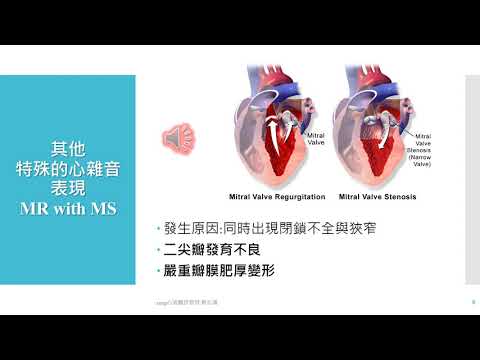 奔馬律