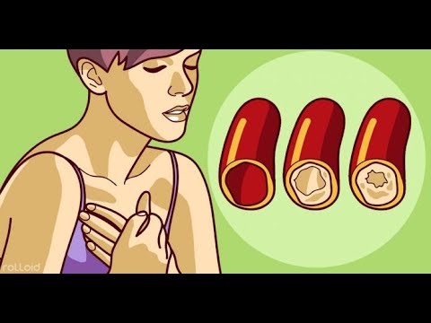 Causas hipertensión resistente Presión óptima sangre 55 años