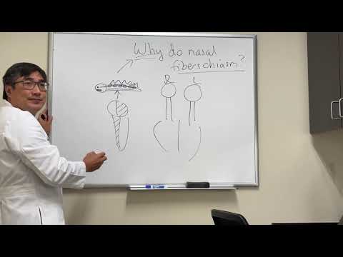 Why do nasal fibers cross at the optic chiasm