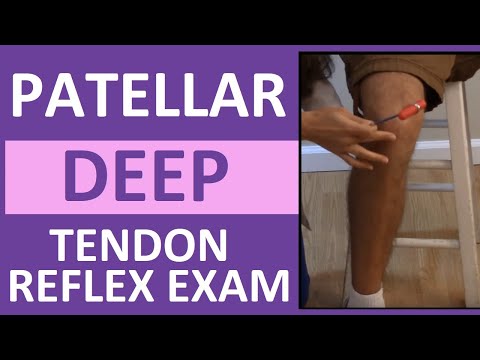 image-How do you test reflexes for patellar tendonitis? 