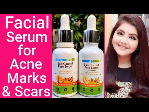Skin correct face serum for acne prone skin | RARA | anti acne facial serum for teenagers | Video