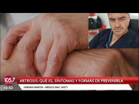 Artrosis: Qué es, síntomas y formas de prevenirla