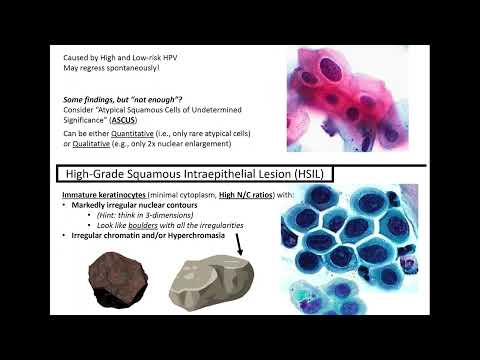 Cervical Cytology: Kurt's Notes #pathagonia