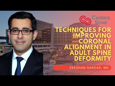 Techniques for Improving Coronal Alignment in Adult Spine Deformity   Zeeshan Sardar, MD