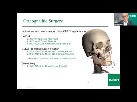 Inion Webinar: Harri Happonen - Inion CPS™ Bioabsorbable Plating System