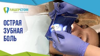 Острая зубная боль. 😬 Причины и способы устранения зубной боли