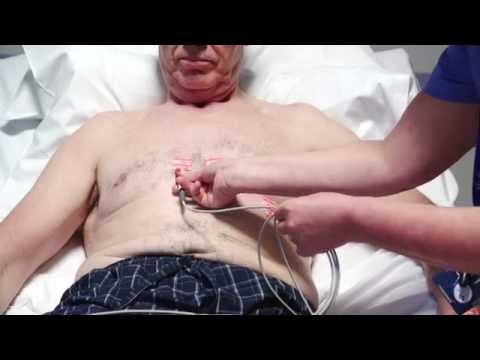 Performing a 12 lead ECG