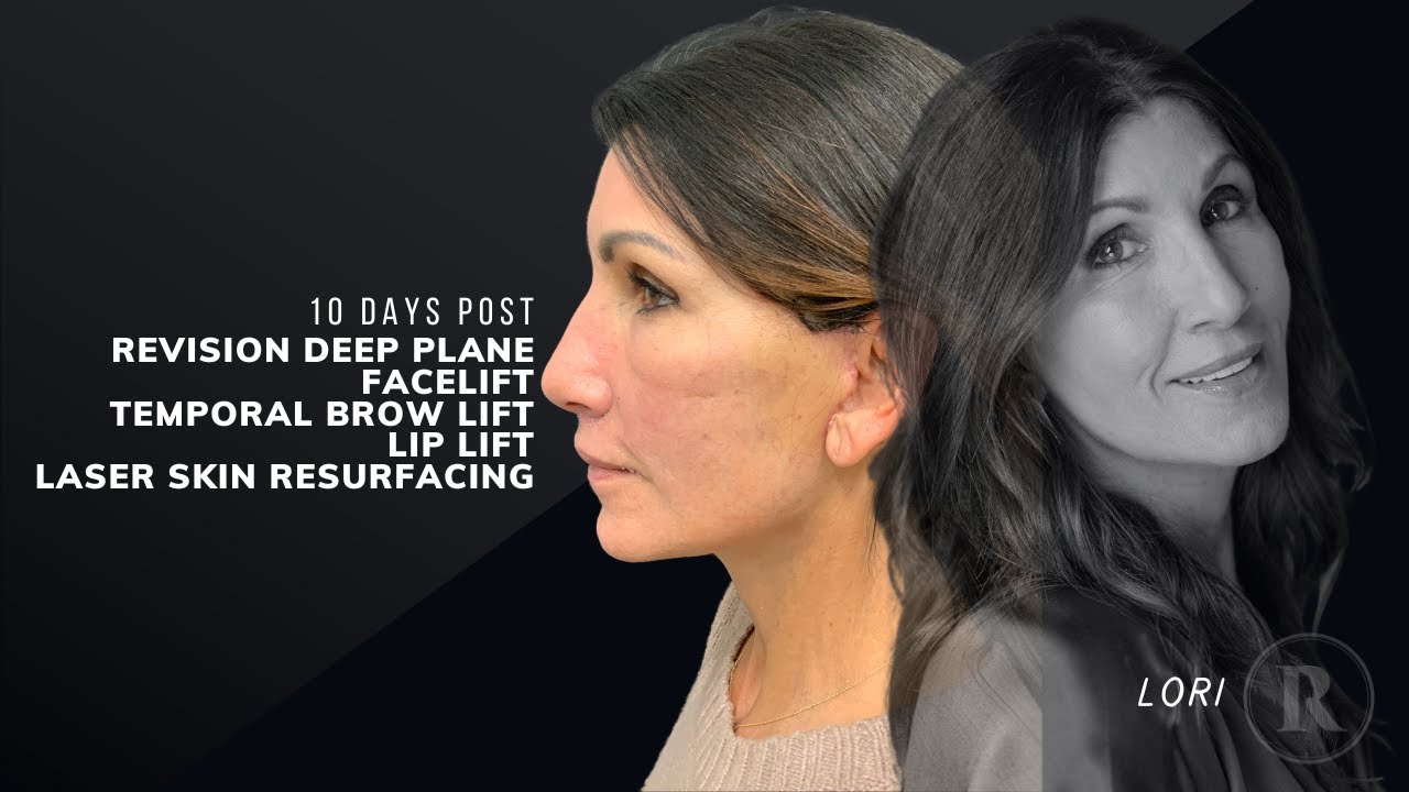 Robb Facial Plastic Surgery