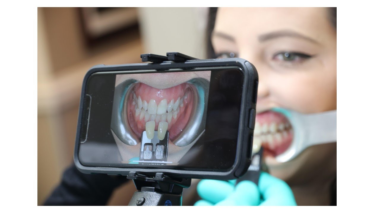 Simplifying Shade Communication