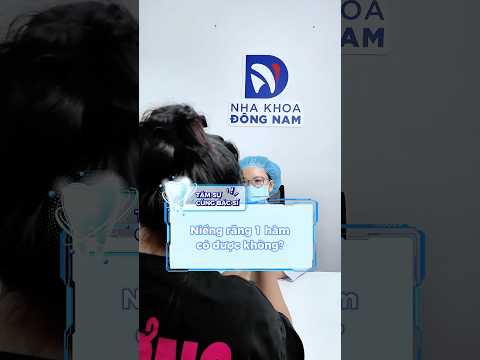 Niềng răng 1 hàm