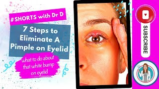 7 Steps to eliminate that bump on eyelid | Pimple on Eye? What to do about it! #shortsyoutube