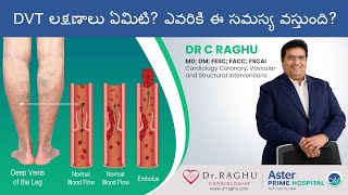 Cure for DVT | Symptoms Causes and medications and exercises for DVT| Dr C Raghu Cardiologist
