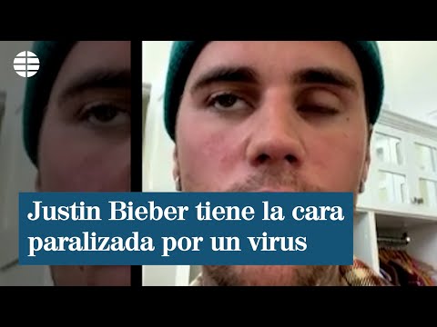 ¿Qué tiene Justin Bieber? Una culebrilla derivada de la lechina