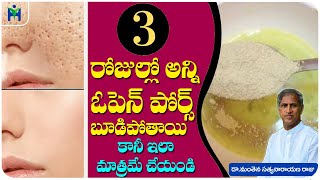 Top 5 Home Remedies For OPEN PORES ( స్కిన్ పై గుంతలకు చెక్ ) | Dr Manthena Satyanarayana Raju