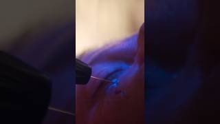 Teaser