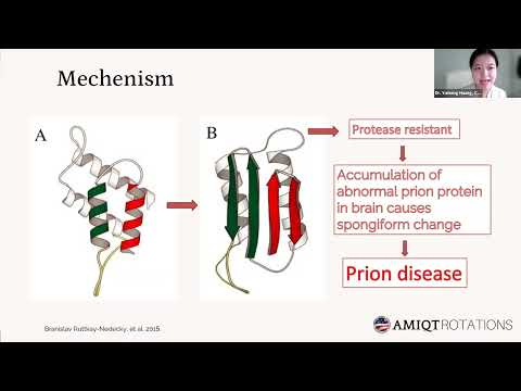AMIQT - Dr Yumeng Huang,, PRION DISEASE